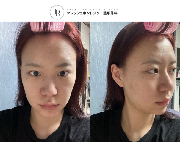 e71eb6b88df56dd41c3002b455c6eeb4_1763013457_7131.jpg e71eb6b88df56dd41c3002b455c6eeb4_1763013457_7131.jpg