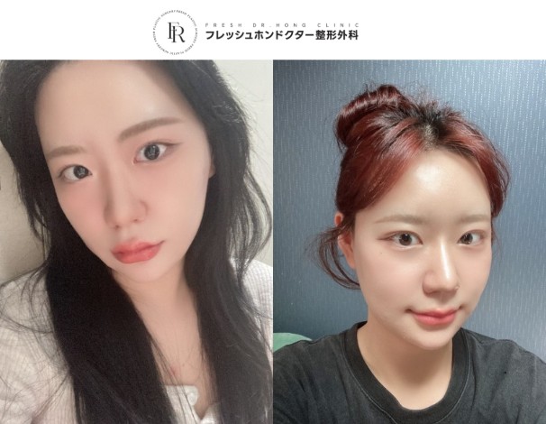 e71eb6b88df56dd41c3002b455c6eeb4_1763013457_7397.jpg e71eb6b88df56dd41c3002b455c6eeb4_1763013457_7397.jpg