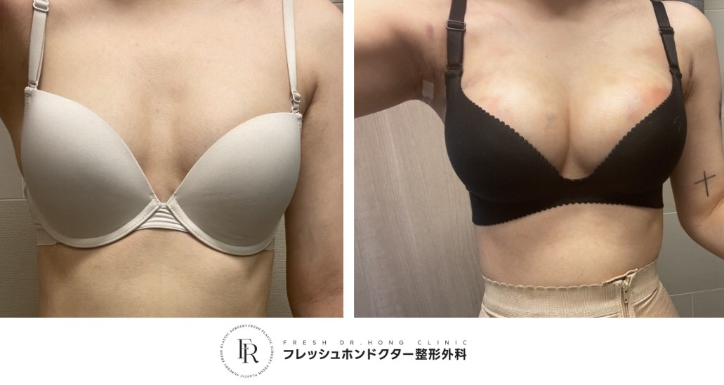 e71eb6b88df56dd41c3002b455c6eeb4_1763014630_8638.jpg e71eb6b88df56dd41c3002b455c6eeb4_1763014630_8638.jpg