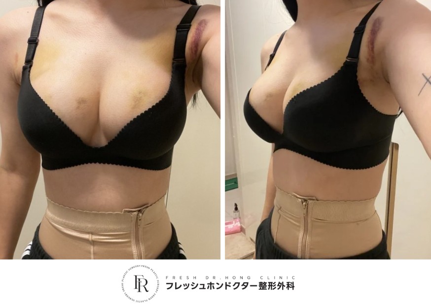 e71eb6b88df56dd41c3002b455c6eeb4_1763014630_9082.jpg e71eb6b88df56dd41c3002b455c6eeb4_1763014630_9082.jpg