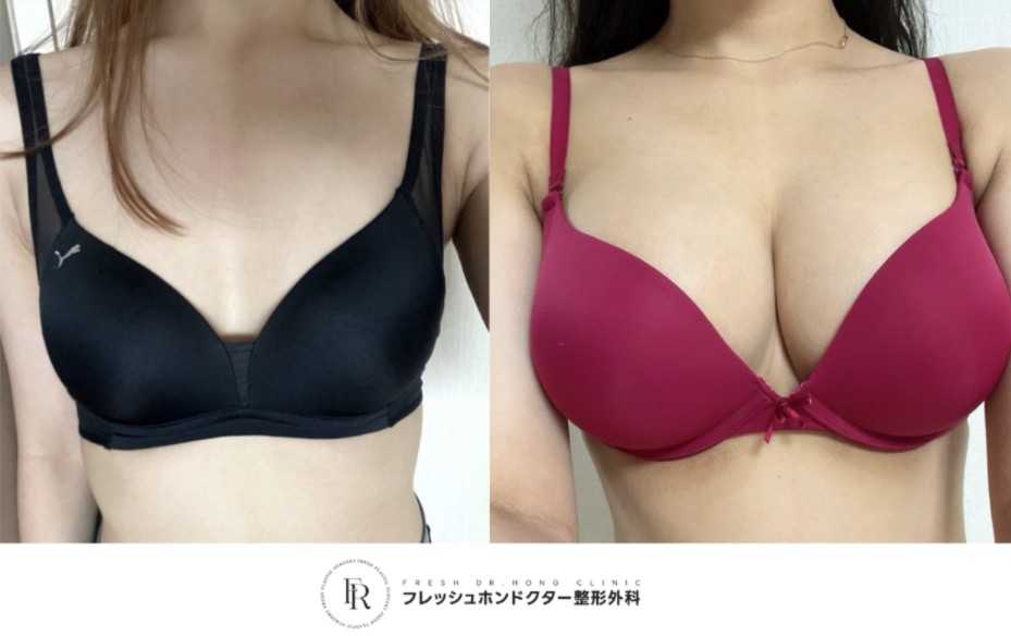 e71eb6b88df56dd41c3002b455c6eeb4_1763021654_6851.jpg e71eb6b88df56dd41c3002b455c6eeb4_1763021654_6851.jpg