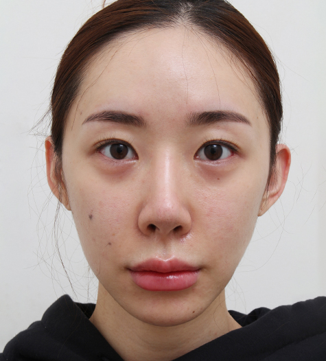 Before Image