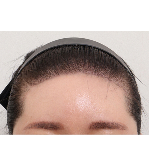 Before Image