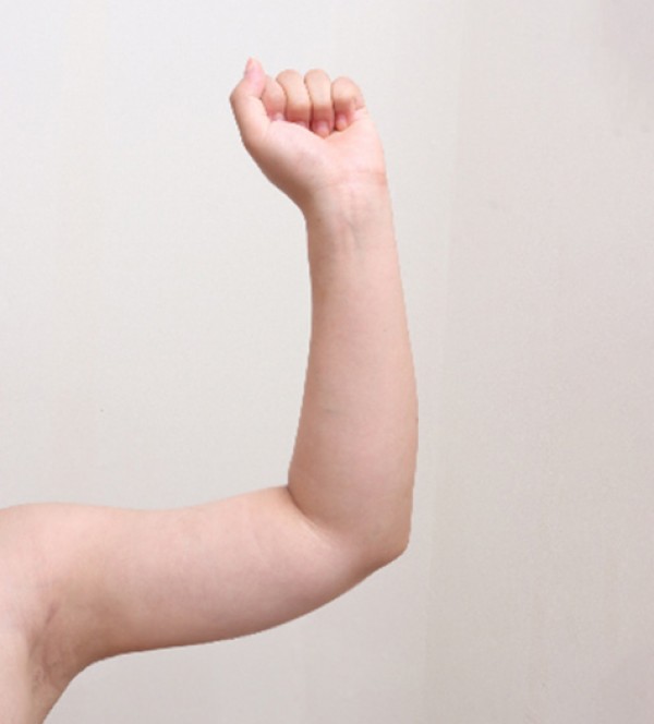 ベイザー2ボディ…