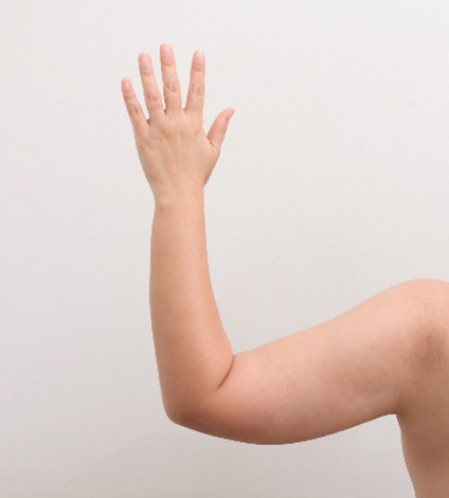 ベイザー2ボディ脂肪吸引