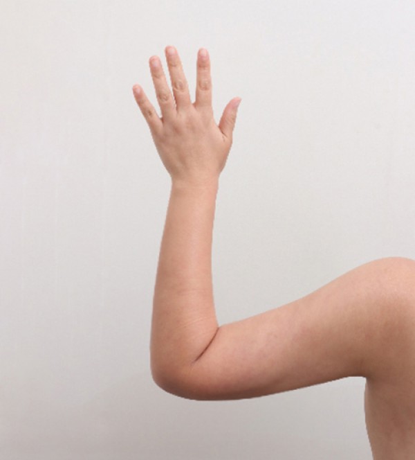 ベイザー2ボディ…