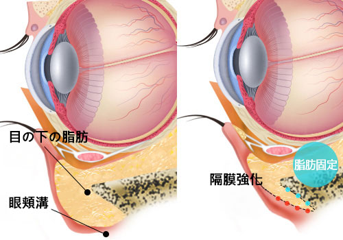 모델