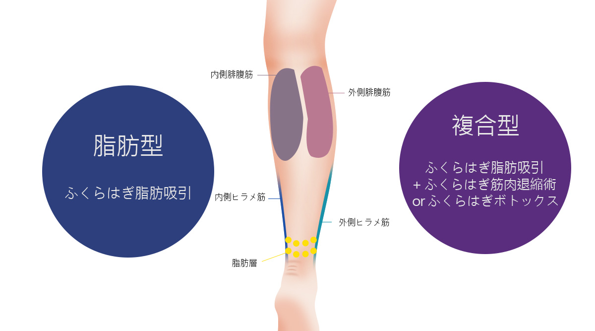 모델