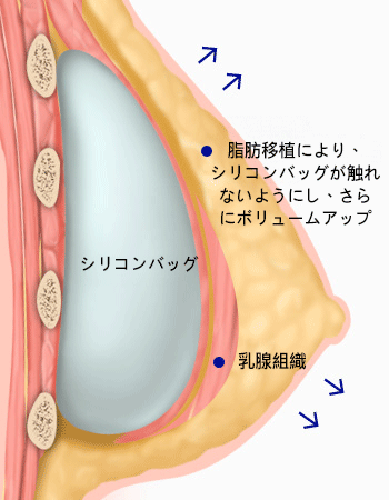 모델