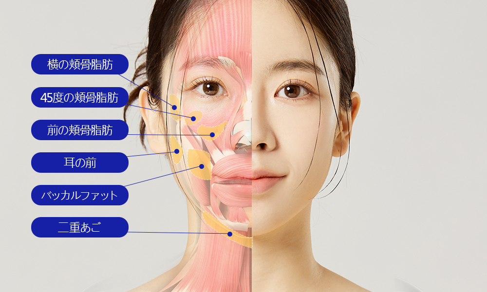 모델