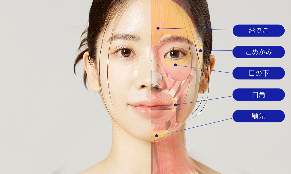 모델