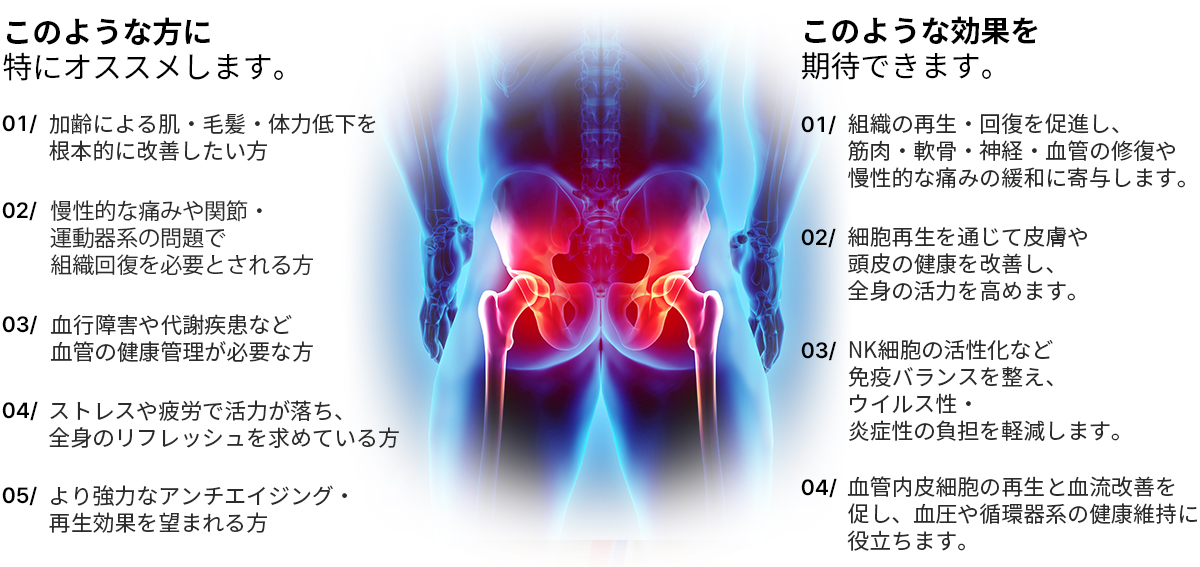 모델