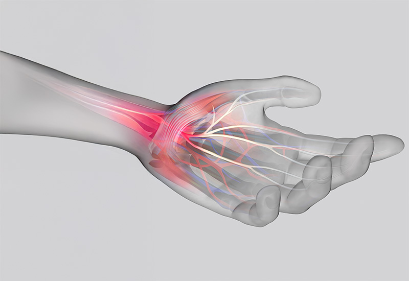 손목·발목 손상